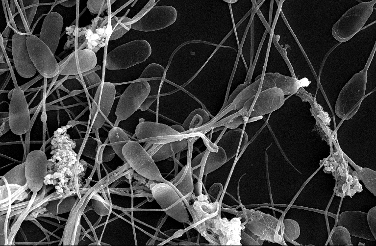 Investigación de productos con sustancias antimicrobianas para reducir la contaminación en las dosis seminales